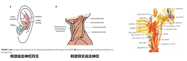 耳甲迷走神經(jīng)刺激器